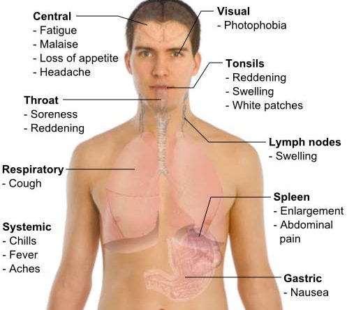 fever lassa medical risk insurance chat telemedicine paramedics response emergency